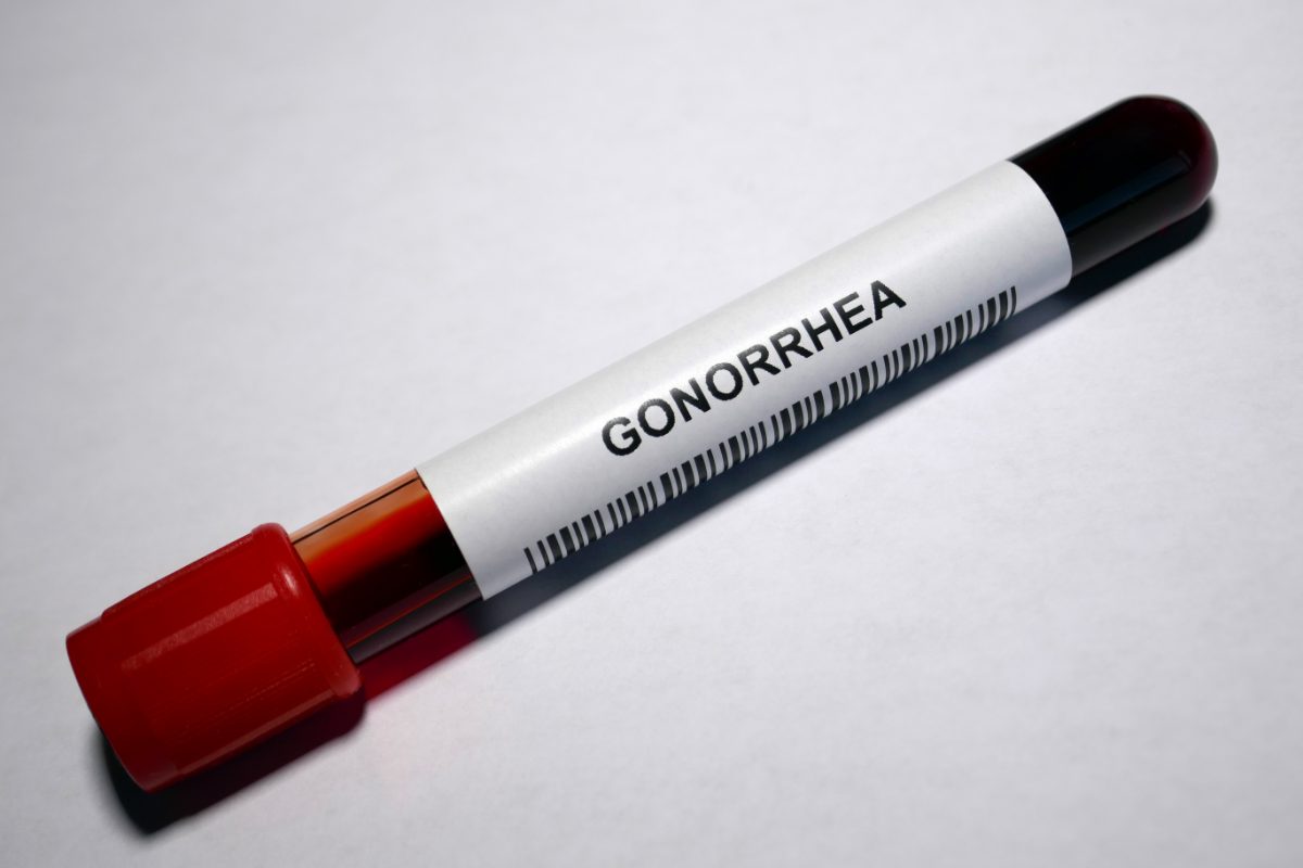 N. gonorrhoeae