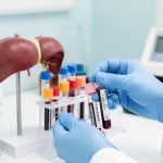 Évaluation médicale d’un bilan hépatique avec des tubes d’échantillons sanguins et un modèle anatomique du foie dans un laboratoire clinique.