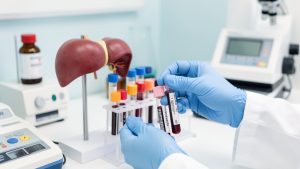 Lire la suite à propos de l’article Gamma-GT à 300 UI/L sans symptôme : que rechercher et quand consulter ?