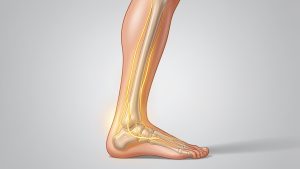 Lire la suite à propos de l’article Douleur sur le côté extérieur du pied : le nerf sural en cause ?