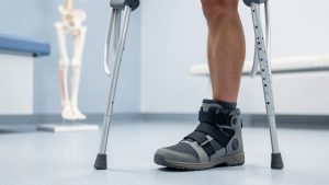Lire la suite à propos de l’article Peut-on marcher avec une fracture du péroné sans l’aggraver ?